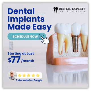 Dental implant campaign creative