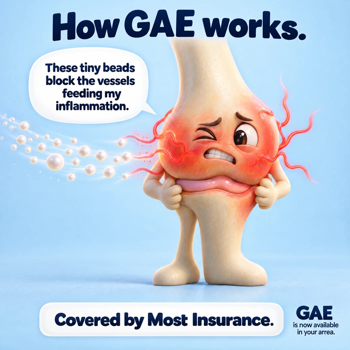 GAE patient education ad with an illustrated knee
